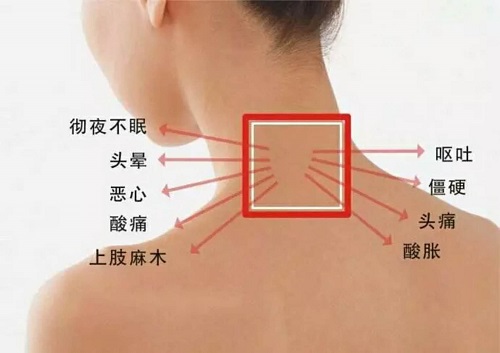 你的頸椎還健康嗎？
