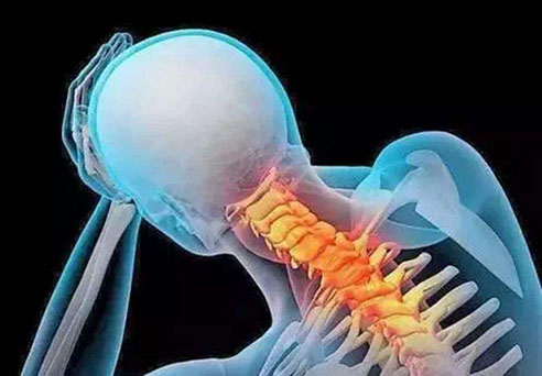頸椎病的相關癥狀