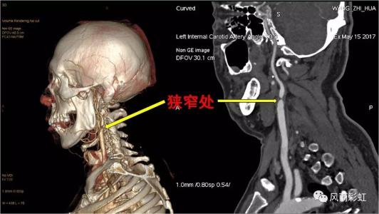 頸椎病都是“積”出來的，4個傷頸的行為，別總是做